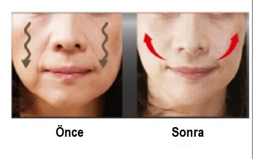 Genetik mirasımız yüzümüzün şeklini belirlese de iyi beslenme alışkanlıkları ve özel bakım harikalar yaratabilir. 